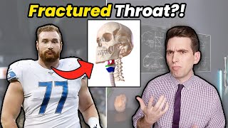 THROAT FRACTURE Doctor Explains Strangest NFL Injury Moments Ever [upl. by Nutter]