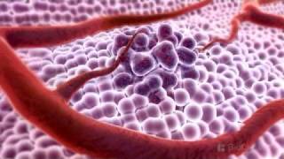 3D Medical Animation  What is Cancer [upl. by Nuj]