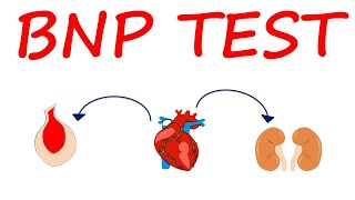 Brain Natriuretic Peptide BNP Test for heart failure [upl. by Enidualc322]