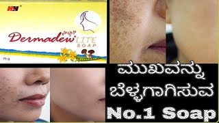 Dermadew Liite Soap Review In KannadaSkin whiteningRemove PigmentationGlowing skin [upl. by Hamon339]