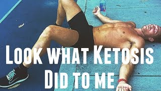 Ketogenic Diets Damage the Liver and Kidneys  Is Ketosis Starvation Mode  How many Carbs [upl. by Chuu229]