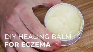 Tutorial for making a Natural Healing Cream for Eczema and Psoriasis [upl. by Spragens]