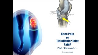 How To Treat Knee Pain The Mechanics  Part 1 [upl. by Lyrehc139]