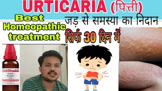 URTICARIAपित्ती Best homeopathic medicine for urticaria खुजली को कहो अलविदा urticaria treatment [upl. by Anivas440]