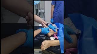 IV canullation how to insert intravenous canulla to vein [upl. by Teloiv810]