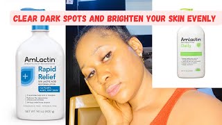 How to Clear dark spots on the body and achieve an Even skin tone with Amlactin body lotion [upl. by Stutsman419]