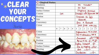 Examination Of The Gingival Status ‖ Health VS Gingival Disease ‖ Gingival Considerations ‖ PerioHub [upl. by Goth]