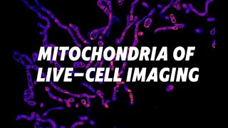 Livecell imaging of mitochondria ｜chinetekscientific1375 [upl. by Suinotna252]