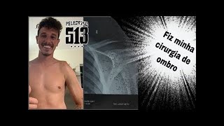 VLOG  Fiz minha Cirurgia de Ombro [upl. by Adrian]