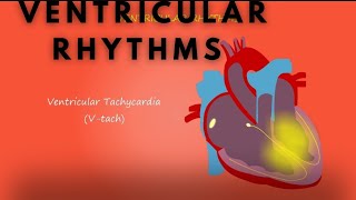 ventricular Rhythms tachycardia amp bradycardia [upl. by Aili]