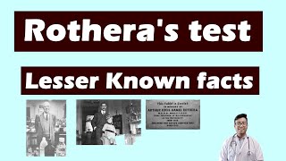 Rotheras Test  Lesser known facts for Class Assistant Gold Medal examinations and PG students [upl. by Lamdin]