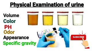 Physical Examination of urine part 2  PH and Specific gravity of urine [upl. by Serena]