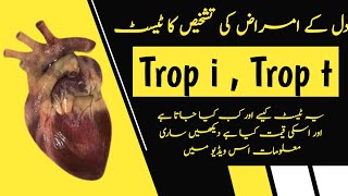 Troponin Enzymes Test in Urdu  Trop i Test  Best Test To Confirm Heart Attack [upl. by Pollie625]