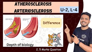 Atherosclerosis  atherosclerosis biochemistry  atherosclerosis pathology  arteriosclerosis [upl. by Ijies]