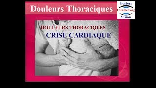 Reconnaitre une crise cardiaque des autres douleurs thoraciques symptomes [upl. by Daniel51]