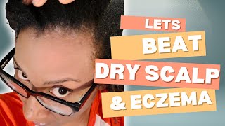 Dealing with Eczema and Scalp Buildup Natural Hair Care Journey [upl. by Flavius]