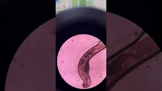 Enterobius vermicularis medtech parasite microscopy [upl. by Terbecki]