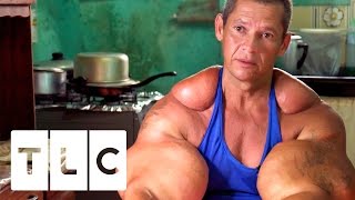 Bodybuilders Inject Muscles With Oil  Real Life Hulks [upl. by Rosenwald]