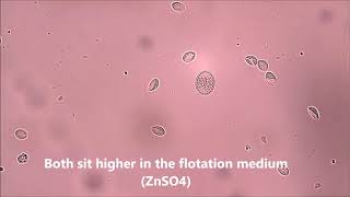 Giardia cysts and Isospora oocyst canine [upl. by Fechter]