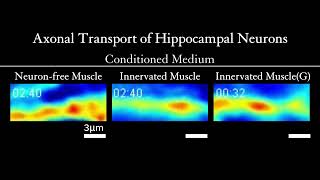 Axonal Transport of Hippocampal Neurons [upl. by Buderus]