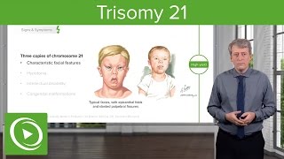 Trisomy 21 Down Syndrome Introduction – Pediatrics  Lecturio [upl. by Elleined]