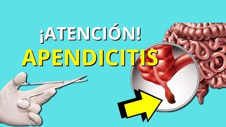 APENDICITIS AGUDA✅ FISIOPATOLOGÍA SINTOMAS Y SIGNOS DIAGNÓSTICO Y TRATAMIENTO RESUMEN EN 6 MIN😱 [upl. by Simson795]