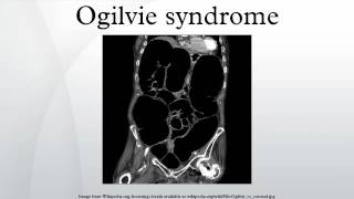 Ogilvie syndrome [upl. by Ellehcal]