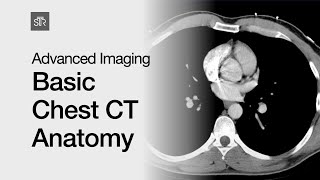 Advanced Imaging Basic Chest CT Anatomy [upl. by Nosyla10]