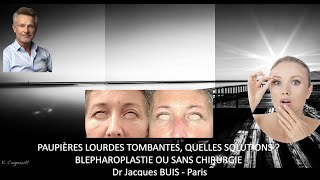 PAUPIERES LOURDES TOMBANTES  QUELLES SOLUTIONS  AVEC BLEPHAROPLASTIE OU SANS CHIRURGIE Dr BUIS J [upl. by Ainnek831]