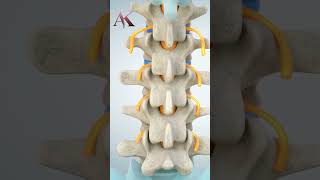 Understanding Intervertebral Discs amp Disc Herniation by Dr Abhijit Kulkarni  Brain amp Spine Surgeon [upl. by Htebiram779]