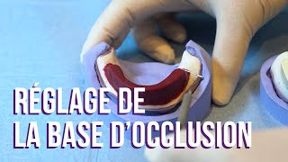 Tuto Prothèse 1 – Le réglage de la base d’occlusion [upl. by Matuag]