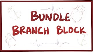 Bundle branch block  causes symptoms diagnosis treatment pathology [upl. by Yrojram]