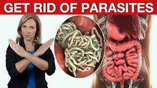 9 Tips to Get Rid of Parasites amp Candida  Dr Janine [upl. by Fayina]