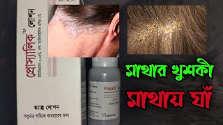 Prosalic Lotion Betamethasone ampSalicylic  মাথার খুঁশকীমাথার চুঁলকানীচুলোর গোড়ায় ইনফেকশন [upl. by Englebert]