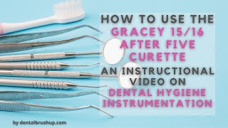 How to use the Gracey 1516 After Five Curette [upl. by Annabal780]