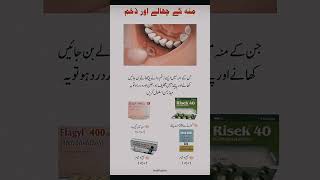 Mouth ulcer treatment [upl. by Tacita346]