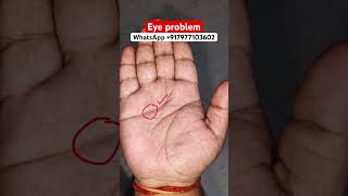 Eye problem astrology palmanalysis palmistry palmstudy palmreading fortunetelling vastu [upl. by Sisson]