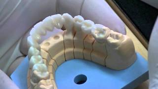 NexxZr Full Contour  Colorazione Zirconia Integrale [upl. by Kwabena]