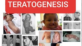 TERATOGENESIS Teratogenic agents and their effects on developing embryo [upl. by Ittam]