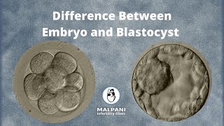 What is the difference between an Embryo and Blastocyst  IVF Specialist [upl. by Repsac307]