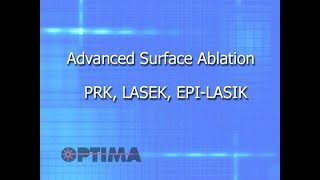 Advanced Surface Ablation – PRK LASEK EPI LASIK [upl. by Wilkison767]