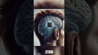 Special Type Of Brain Chip 🧠 STAIN shortsfeed facts neuralink trending factsmine elonmusk [upl. by Donaghue]