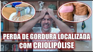 Criolipolise para perda de gordura localizada [upl. by Crissy]