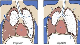 Pneumothorax amp hydropneumothorax  Chest Disease [upl. by Naliorf]