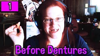 Denture Adventure v10  quotBEFORE DENTURESquot [upl. by Eanram]