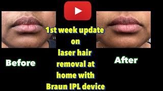 1st SessionHair Removal at homeBraun IPLtamiltrendingbraunfacialhairremovalforwomen [upl. by Oremar]