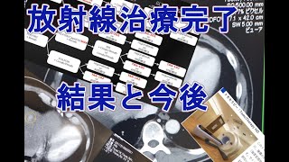 【大腸がんステージⅣ多発肝転移】放射線治療で手術不可の腫瘍は取れたのか！？結果発表～！【現在闘病中⑨】 [upl. by Janela]