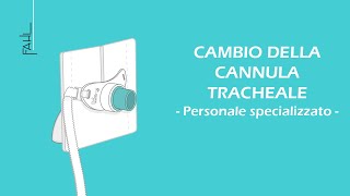 Cambio della cannula tracheale per il personale infermieristico  Fahl MedizintechnikVertrieb GmbH [upl. by Adriana904]