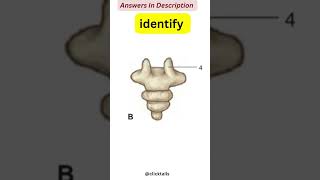 identify the parts of vertebrae Quiz  vertebral column anatomy quiz [upl. by Avrom]