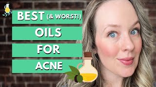 Best carrier oil for acne prone skin  DOS amp DONTS [upl. by Amice589]